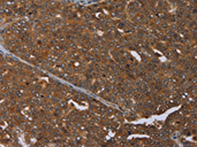 MCHR1 Antibody