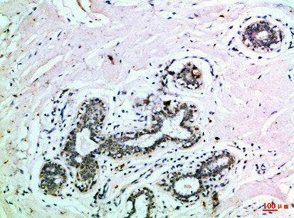EPHB3 Antibody