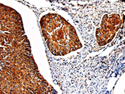 PKM Antibody