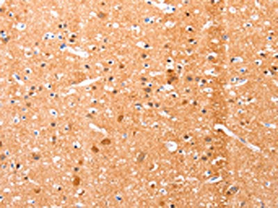 EFNA1 Antibody