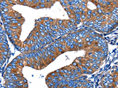 MERTK Antibody