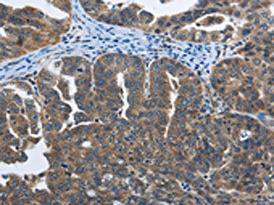 SYT3 Antibody