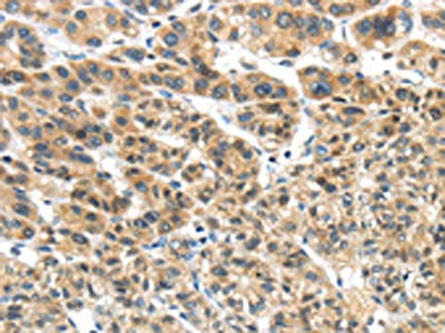 TKTL1 Antibody