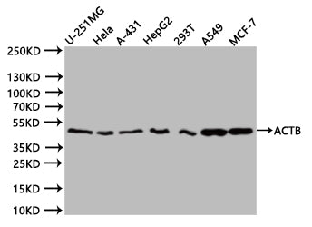 ACTB Recombinant Monoclonal Antibody