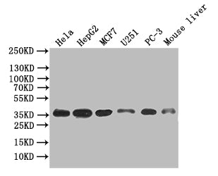ANXA4 Recombinant Monoclonal Antibody
