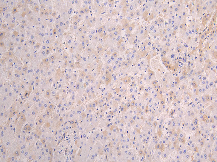 APCS Recombinant Monoclonal Antibody