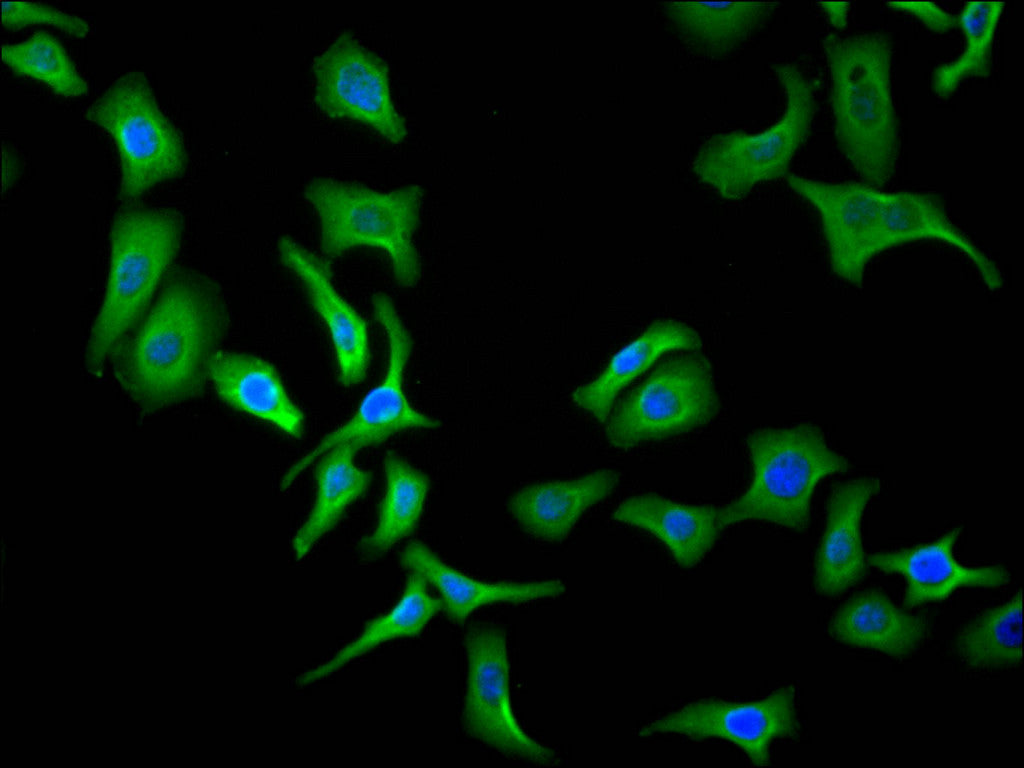 APP Recombinant Monoclonal Antibody