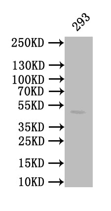 CALR Recombinant Monoclonal Antibody