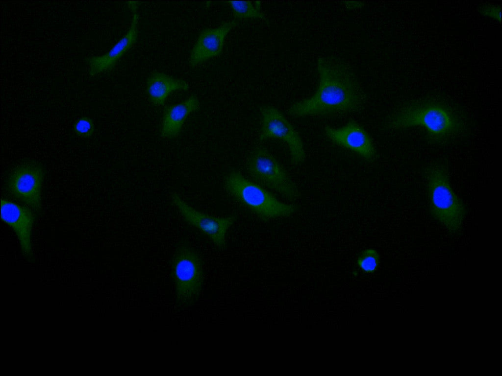 CDH11 Recombinant Monoclonal Antibody