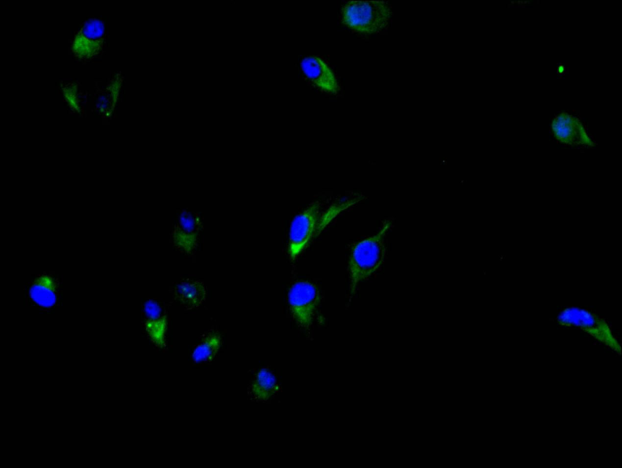 CEACAM5 Recombinant Monoclonal Antibody
