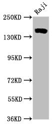CD21 Antibody