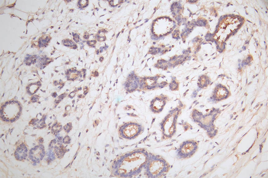 CTNNB1 Recombinant Monoclonal Antibody