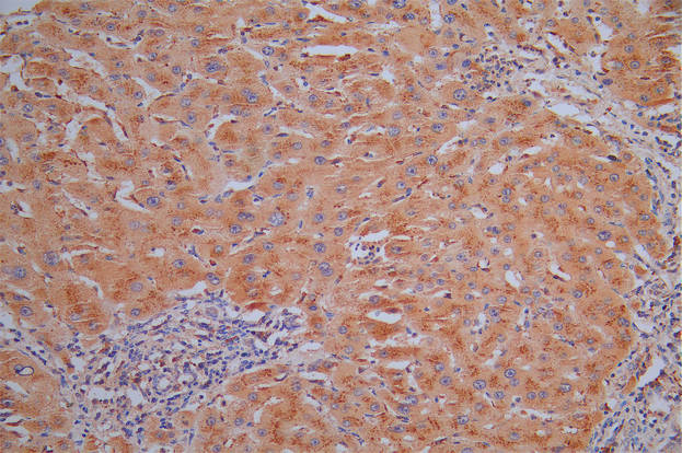 CTSL Recombinant Monoclonal Antibody