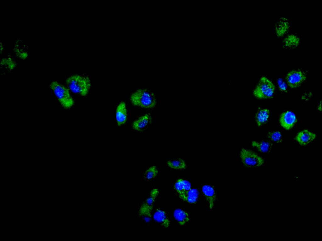 CYBB Recombinant Monoclonal Antibody
