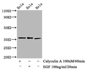 Phospho-EIF2S1 (S51) Antibody