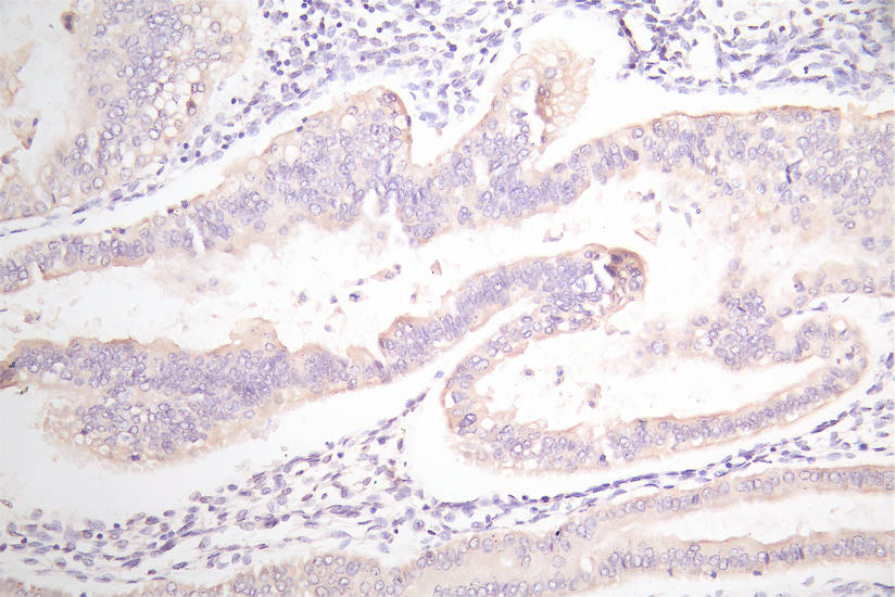 EPCAM Recombinant Monoclonal Antibody