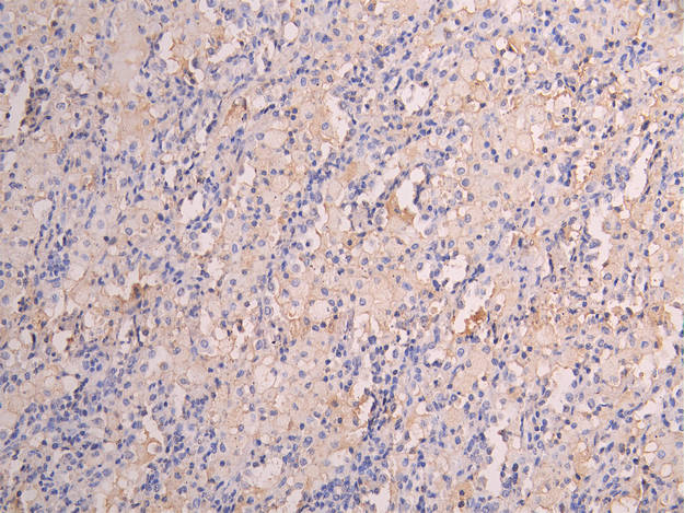 FCGRT Recombinant Monoclonal Antibody