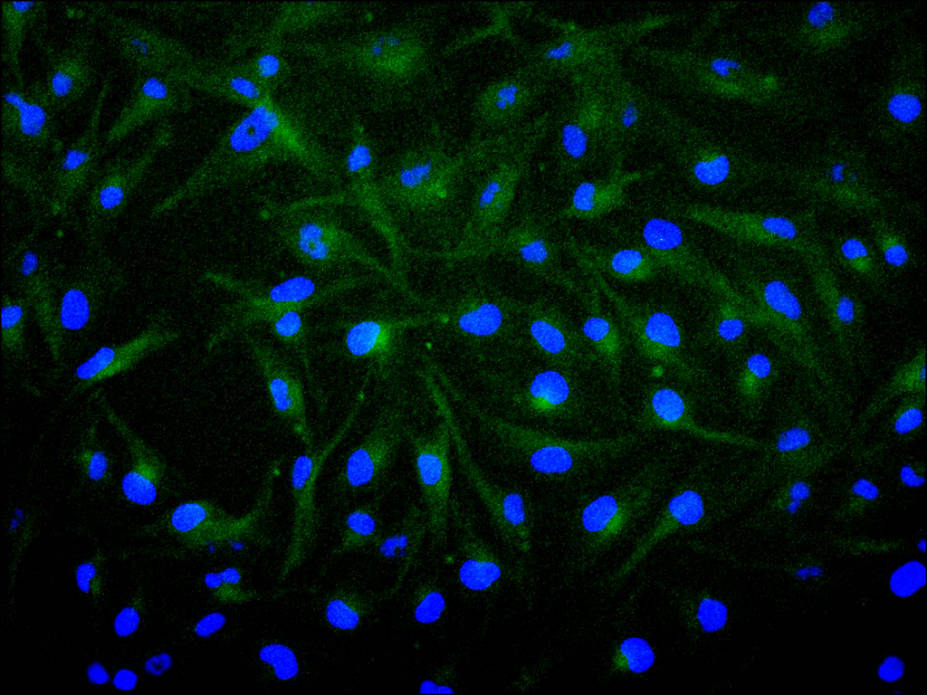 FGF1 Recombinant Monoclonal Antibody