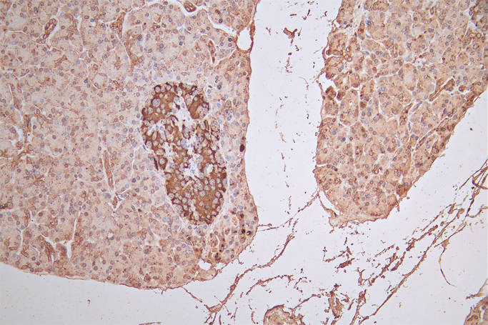FGFR1 Recombinant Monoclonal Antibody
