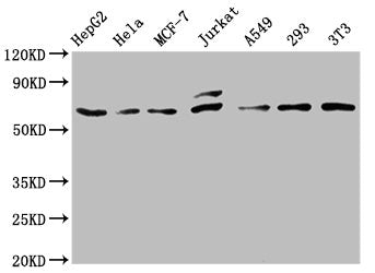 FOS Antibody
