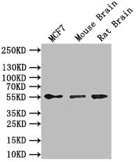 GFAP Recombinant Monoclonal Antibody