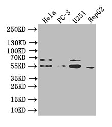 GIPR Recombinant Monoclonal Antibody