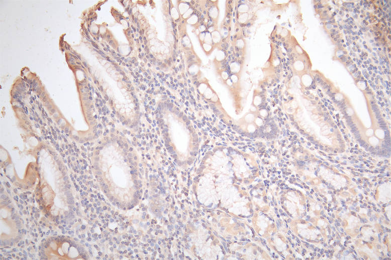 GJB2 Recombinant Monoclonal Antibody