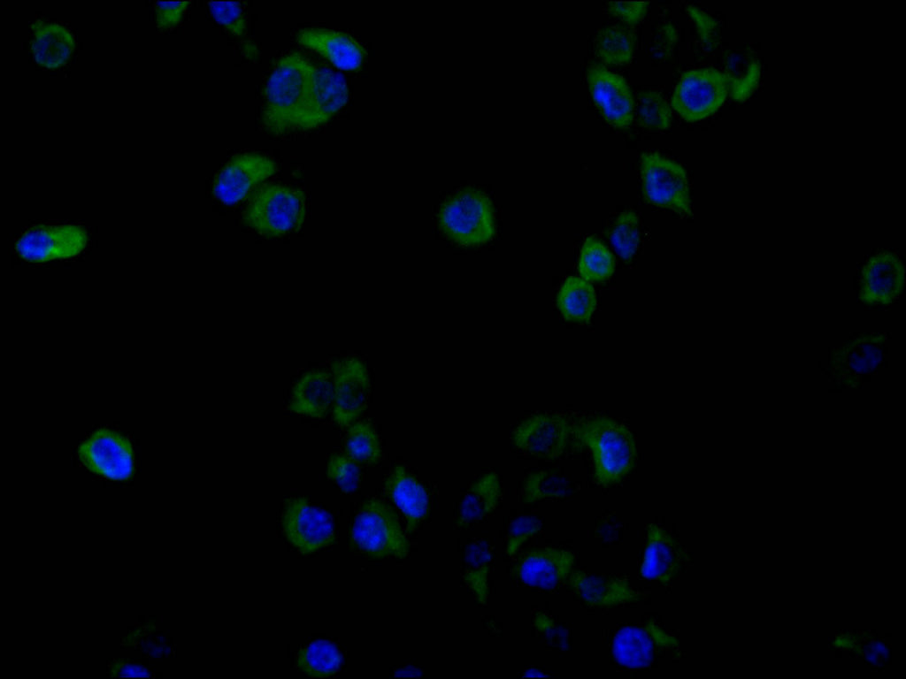 GLP1R Recombinant Monoclonal Antibody
