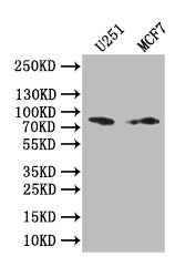 GSN Recombinant Monoclonal Antibody