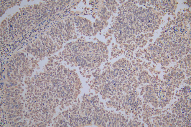 HSPB1 Recombinant Monoclonal Antibody