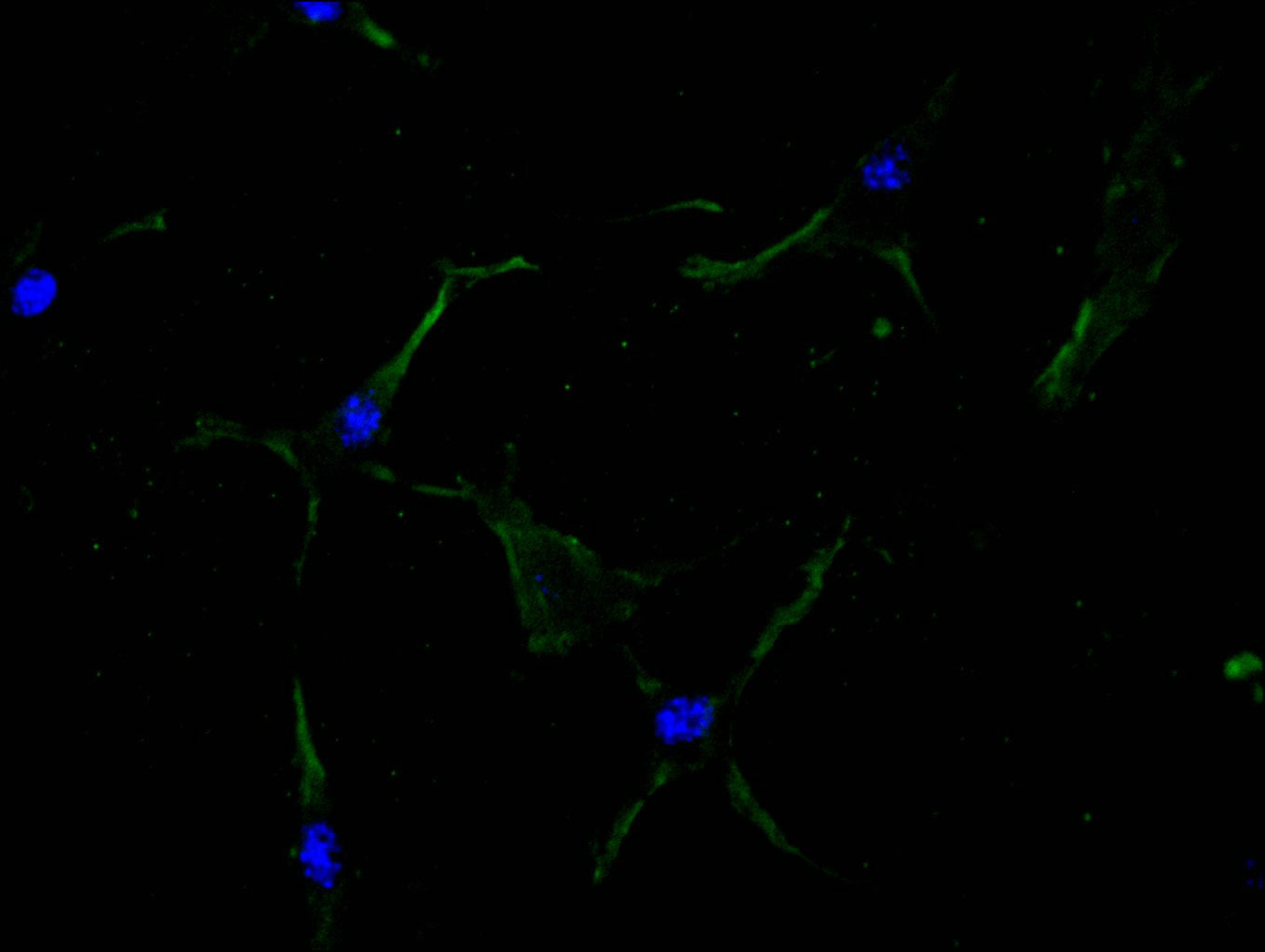 ITGAV Recombinant Monoclonal Antibody