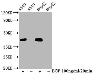 Phospho-MAPK3 (T202) + MAPK1 (T185) Antibody