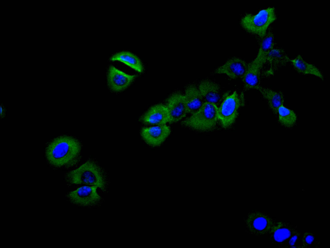 MET Recombinant Monoclonal Antibody