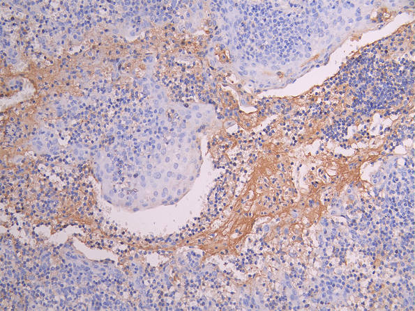 MMP9 Recombinant Monoclonal Antibody