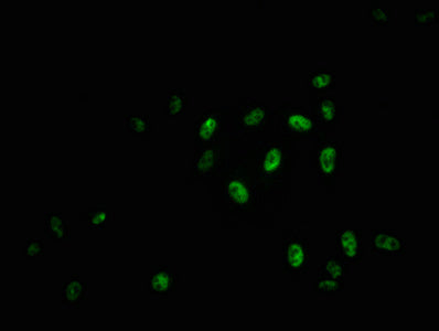 Phospho-MYB (S11) Antibody
