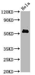Phospho-MYC (S62) Antibody