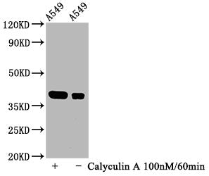 Phospho-NFKBIA (S32) Antibody