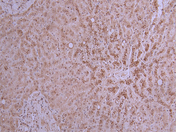 PCSK9 Recombinant Monoclonal Antibody