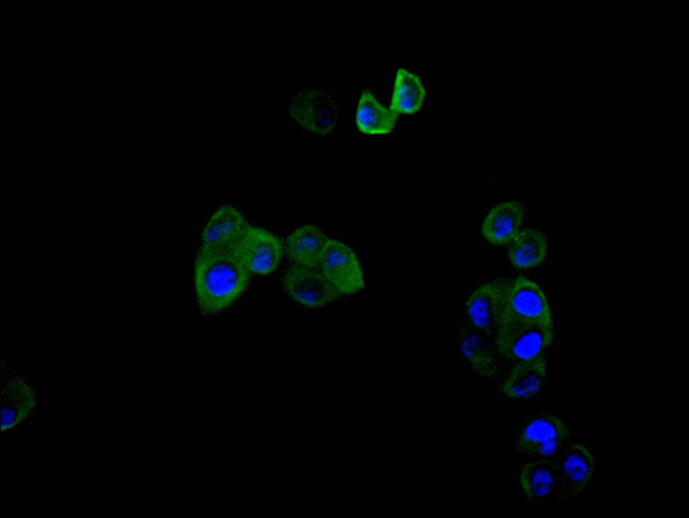 PLAUR Recombinant Monoclonal Antibody