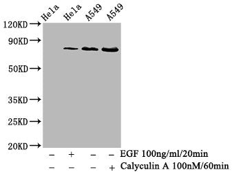 Phospho-PRKCA (T638) Antibody
