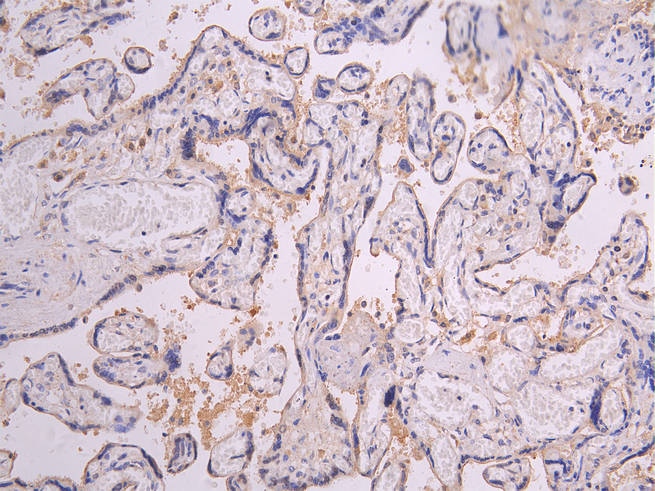 PRLR Recombinant Monoclonal Antibody