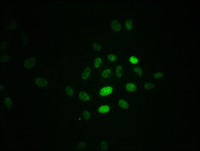 Phospho-RPA2 (T21) Antibody