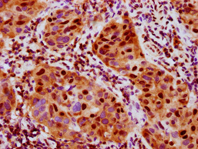 Phospho-RPS6KA5 (S376) Antibody