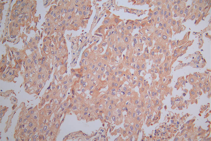 SLAMF7 Recombinant Monoclonal Antibody
