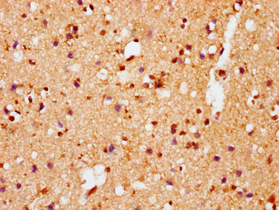 Phospho-SNCA (S129) Antibody