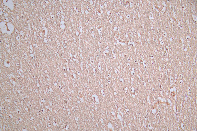 SNCA Recombinant Monoclonal Antibody