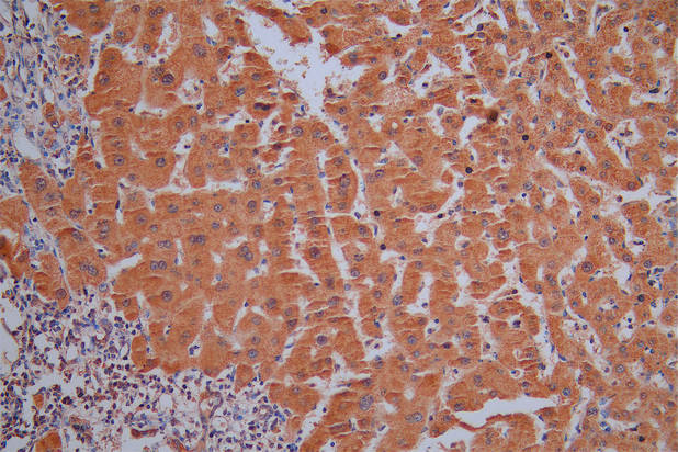 SNCG Recombinant Monoclonal Antibody