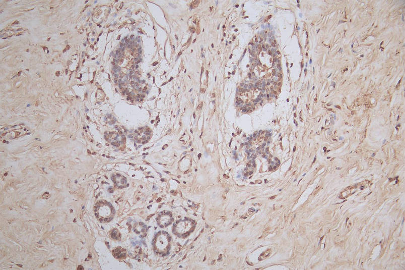 SNRPD1 Recombinant Monoclonal Antibody