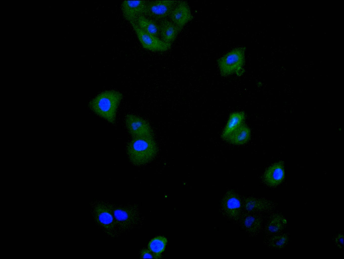 SOD1 Recombinant Monoclonal Antibody