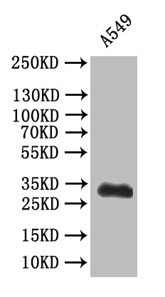 SYP Recombinant Monoclonal Antibody